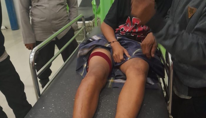Remaja 14 Tahun Jadi Korban Penusukan di Wonomulyo, Polisi Lakukan Penyelidikan